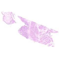 Human FFPE NAT Bladder Tissue HuN-03-0057