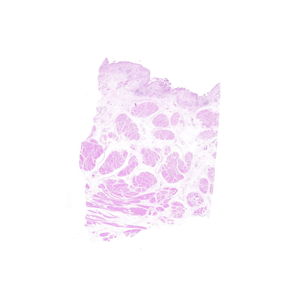 Human FFPE NAT Bladder Tissue HuN-03-0058A