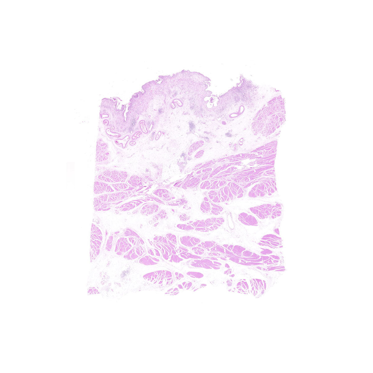 Human FFPE NAT Bladder Tissue HuN-03-0058B