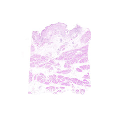 Human FFPE NAT Bladder Tissue HuN-03-0058B