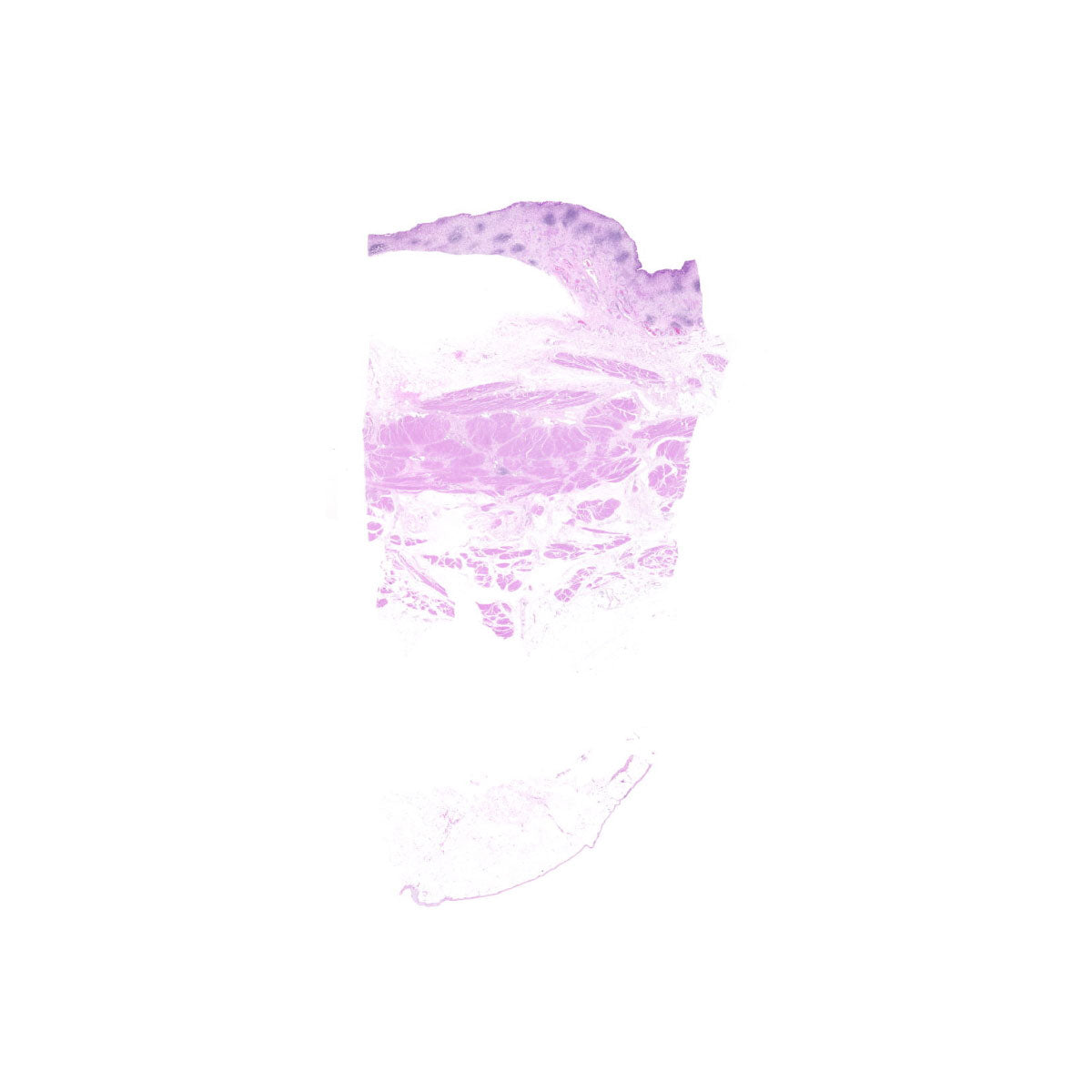 Human FFPE NAT Bladder Tissue HuN-03-0059A
