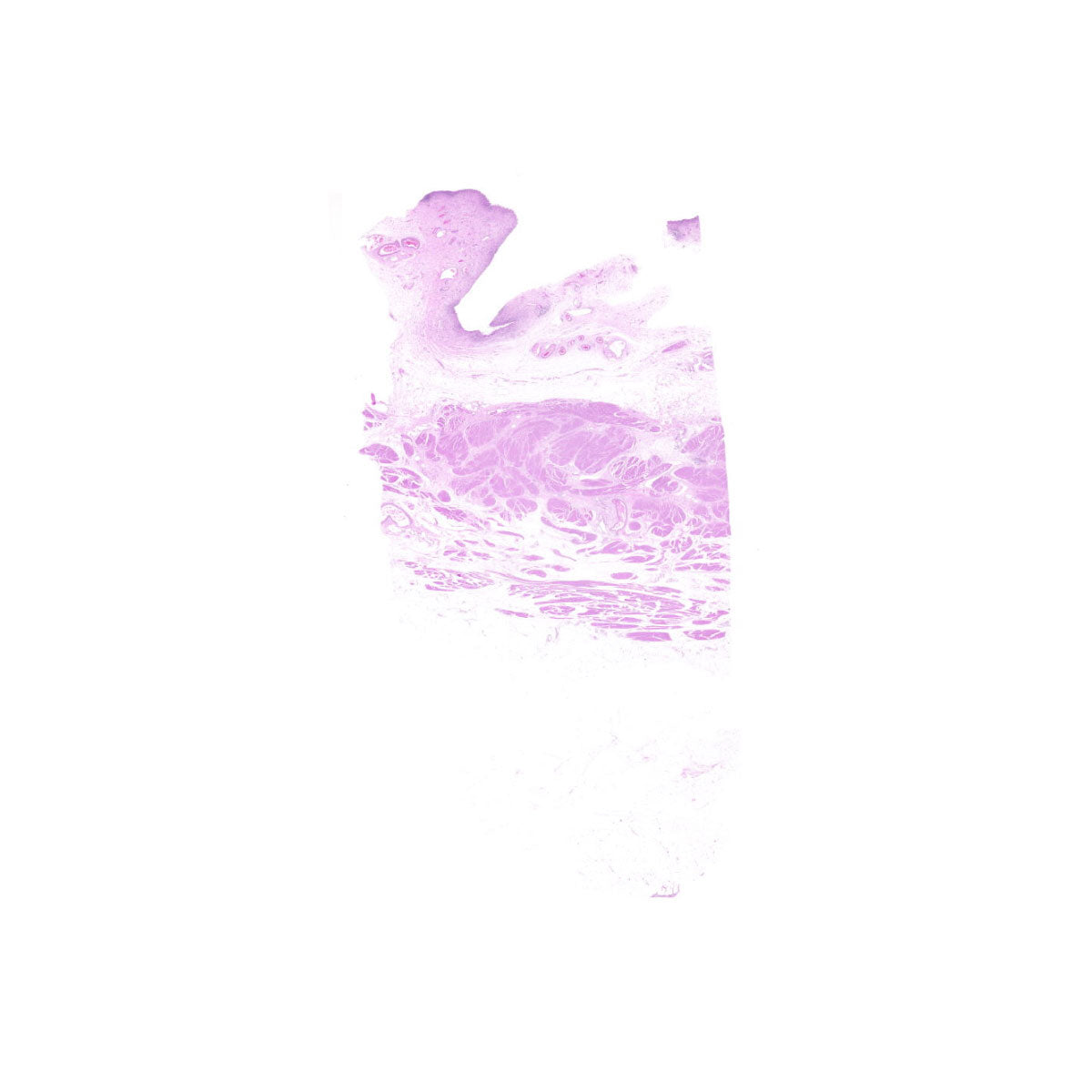 Human FFPE NAT Bladder Tissue HuN-03-0059B