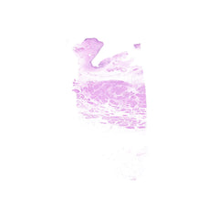 Human FFPE NAT Bladder Tissue HuN-03-0059B