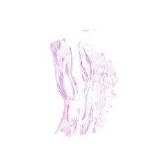 Human FFPE NAT Bladder Tissue HuN-03-0060