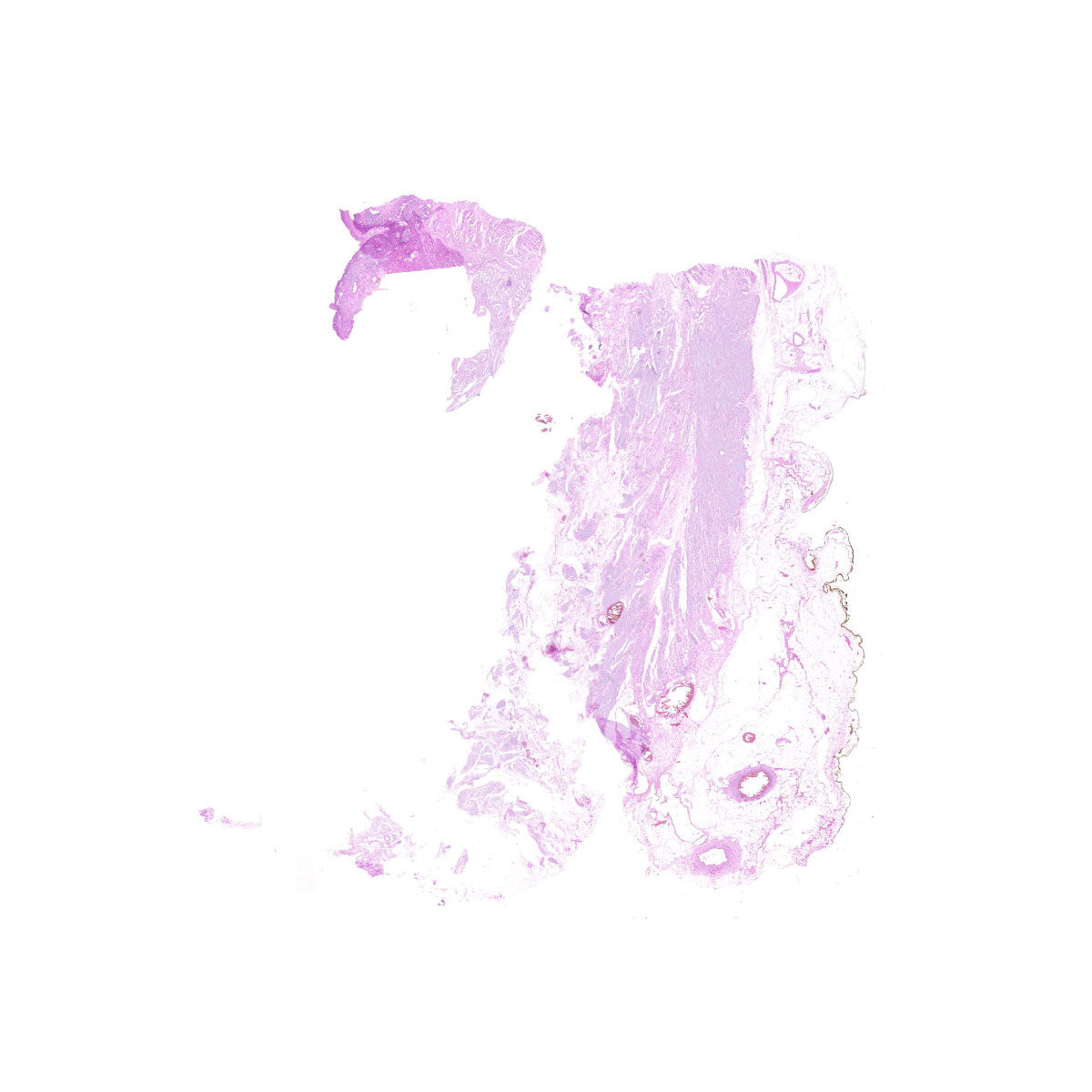 Human FFPE NAT Bladder Tissue HuN-03-0061