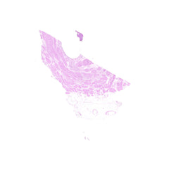 Human FFPE NAT Bladder Tissue HuN-03-0062