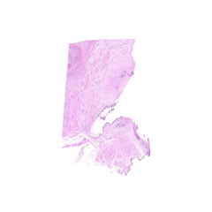 Human FFPE NAT Bladder Tissue HuN-03-0064A