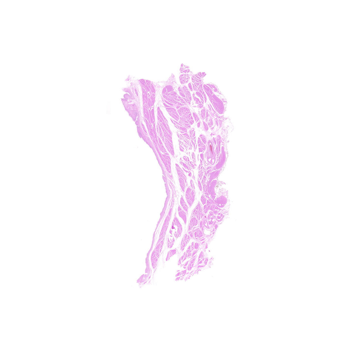 Human FFPE NAT Bladder Tissue HuN-03-0065