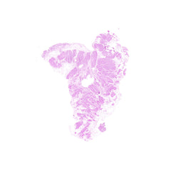 Human FFPE NAT Bladder Tissue HuN-03-0066