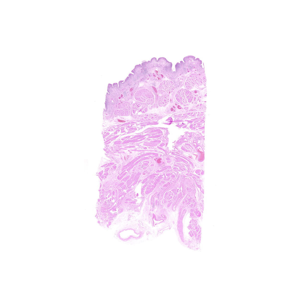 Human FFPE NAT Bladder Tissue HuN-03-0068A