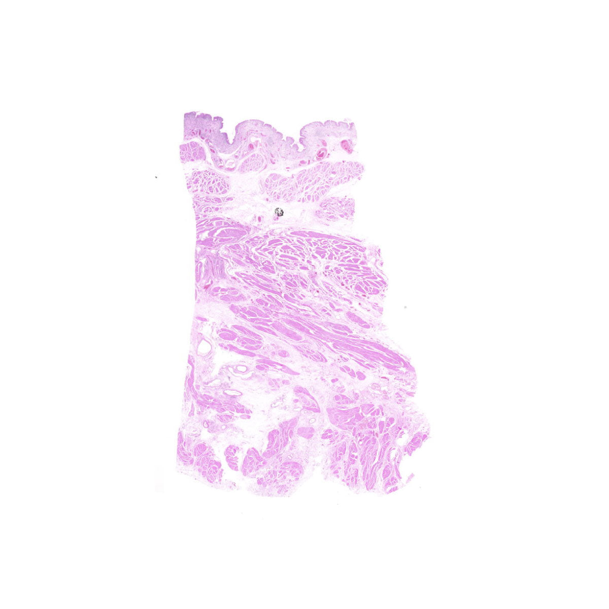 Human FFPE NAT Bladder Tissue HuN-03-0068B