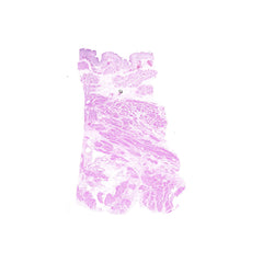 Human FFPE NAT Bladder Tissue HuN-03-0068B