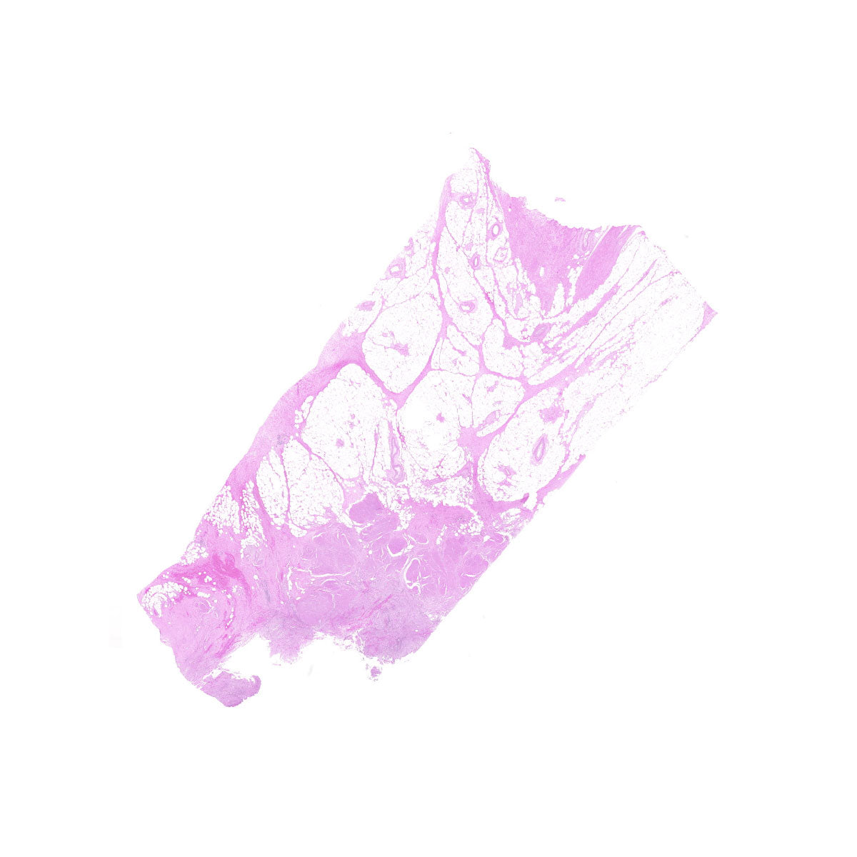 Human FFPE NAT Bladder Tissue HuN-03-0070A