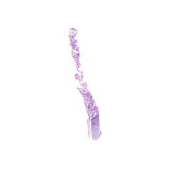 Human FFPE NAT Bone Tissue HuN-04-0001