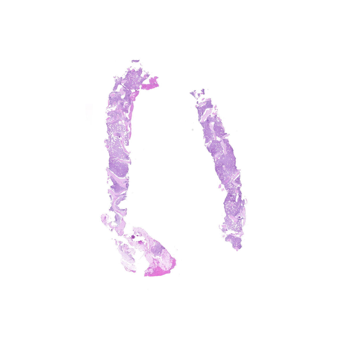 Human FFPE NAT Bone Tissue HuN-04-0002