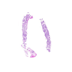 Human FFPE NAT Bone Tissue HuN-04-0002