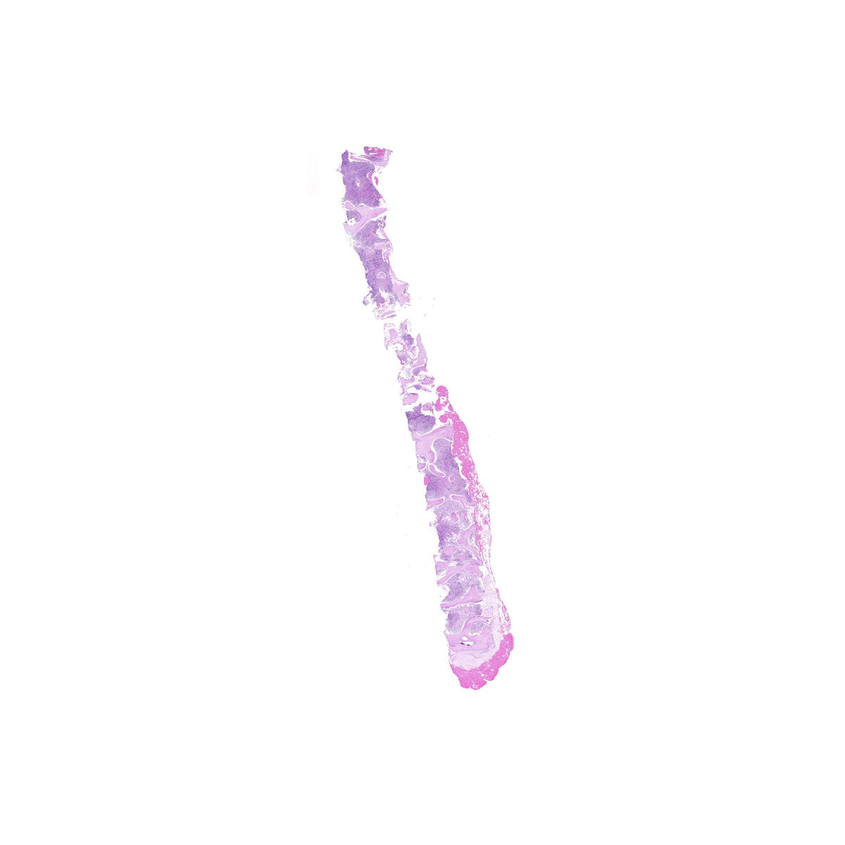 Human FFPE NAT Bone Tissue HuN-04-0003