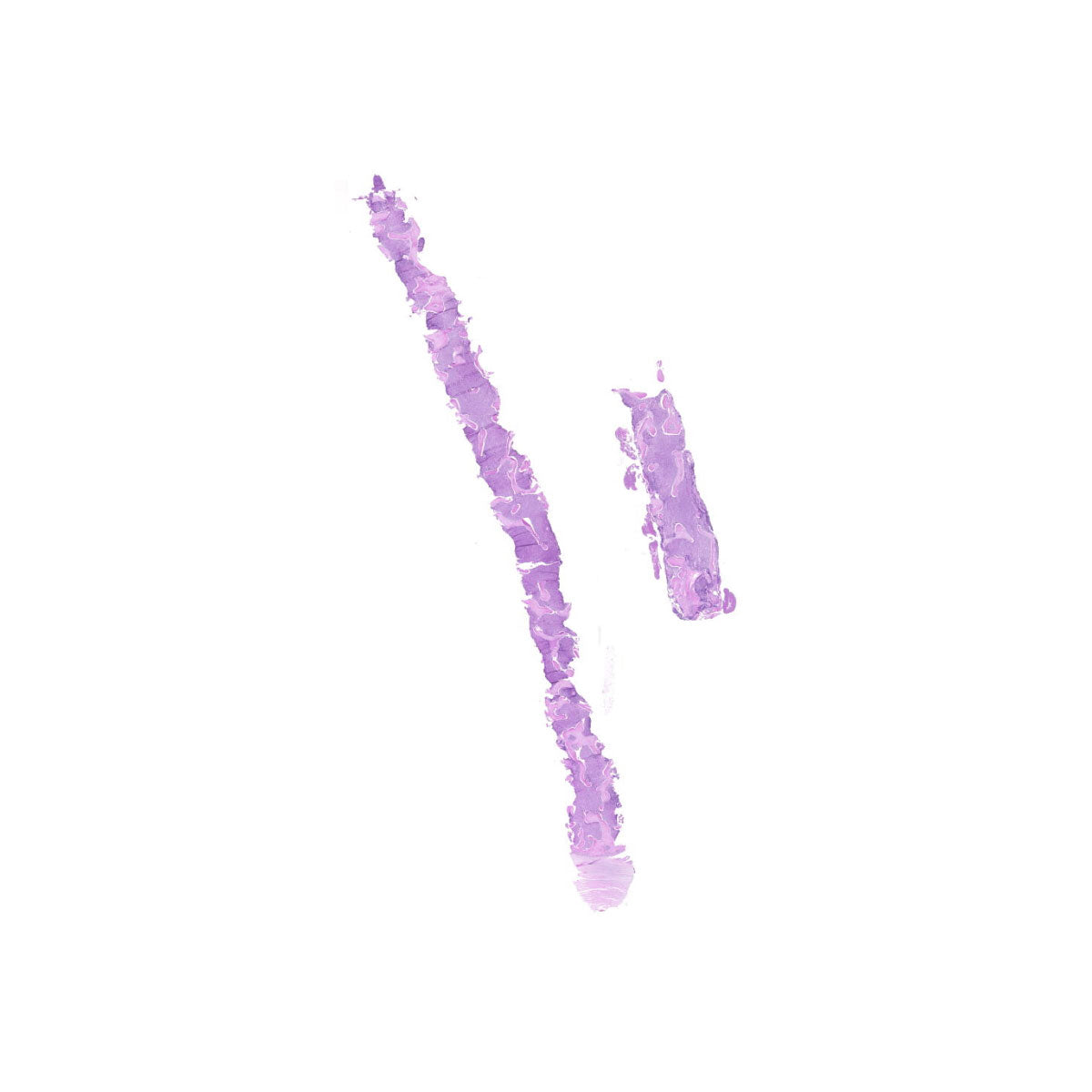 Human FFPE NAT Bone Tissue HuN-04-0004