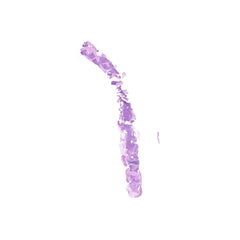 Human FFPE NAT Bone Tissue HuN-04-0006