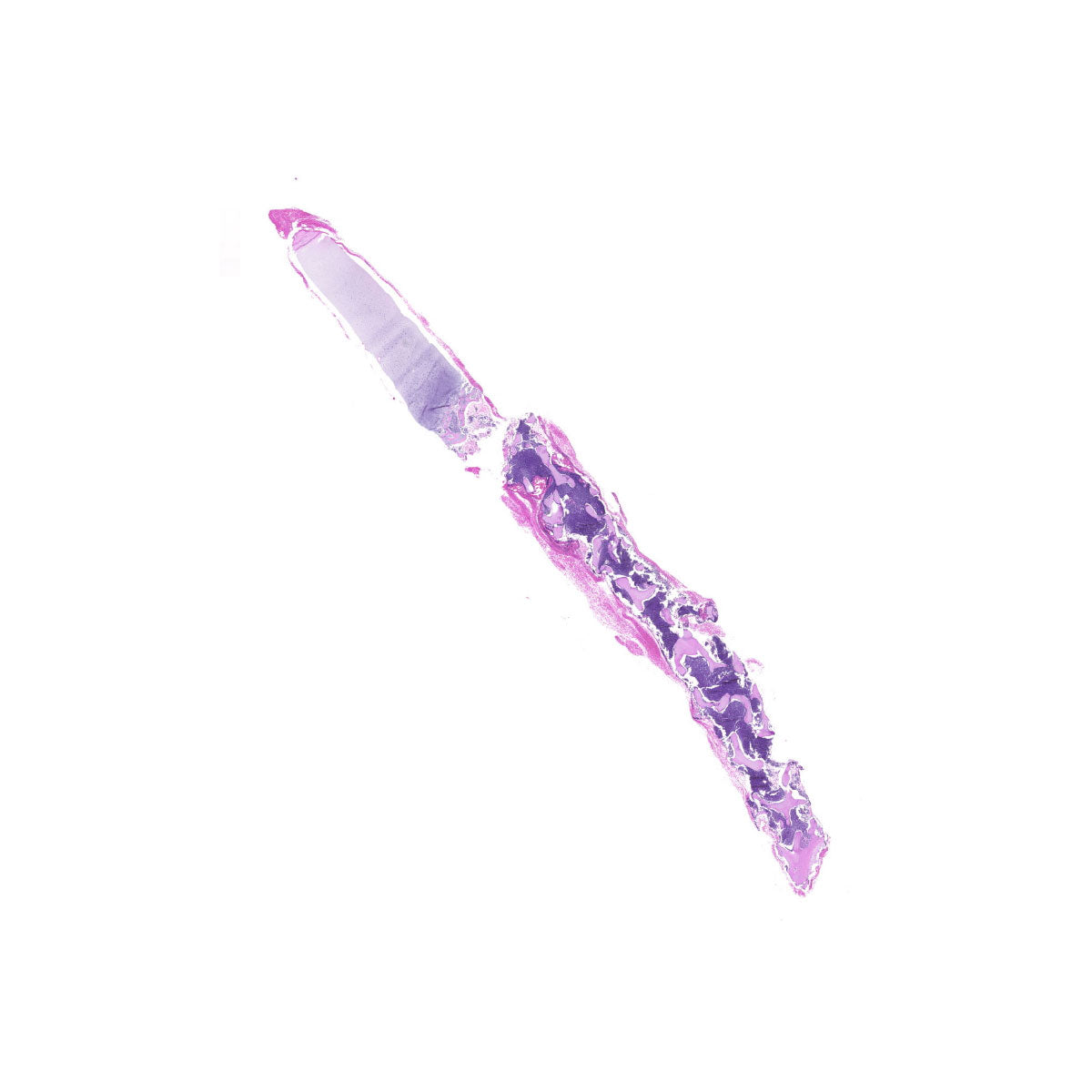 Human FFPE NAT Bone Tissue HuN-04-0007