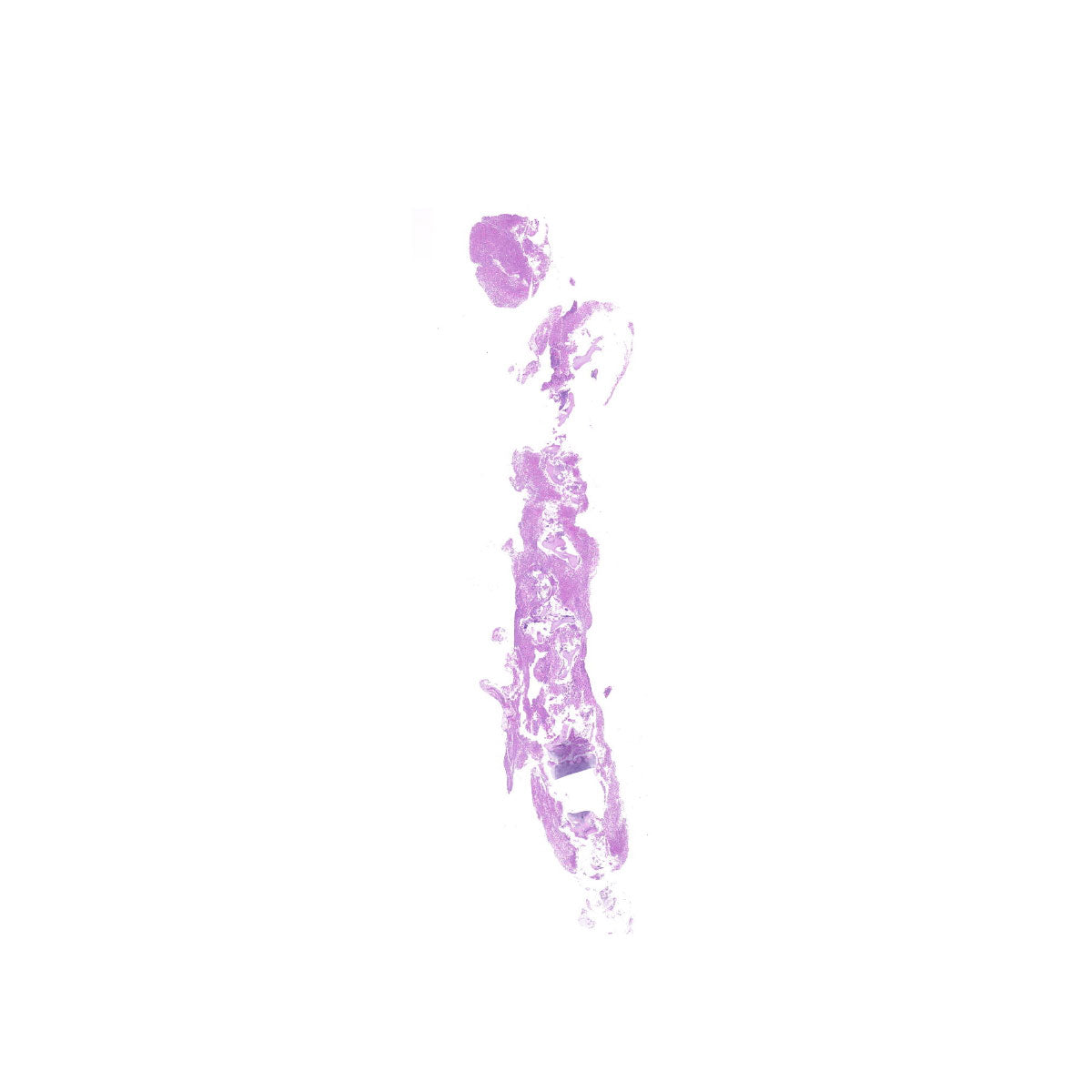 Human FFPE NAT Bone Tissue HuN-04-0009