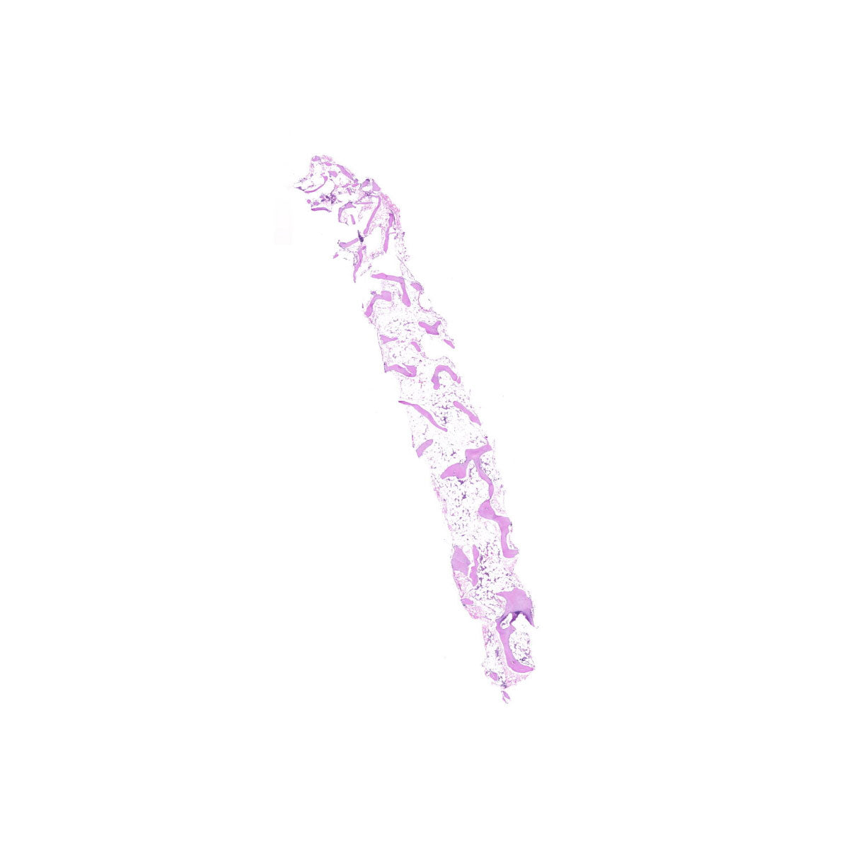 Human FFPE NAT Bone Tissue HuN-04-0011