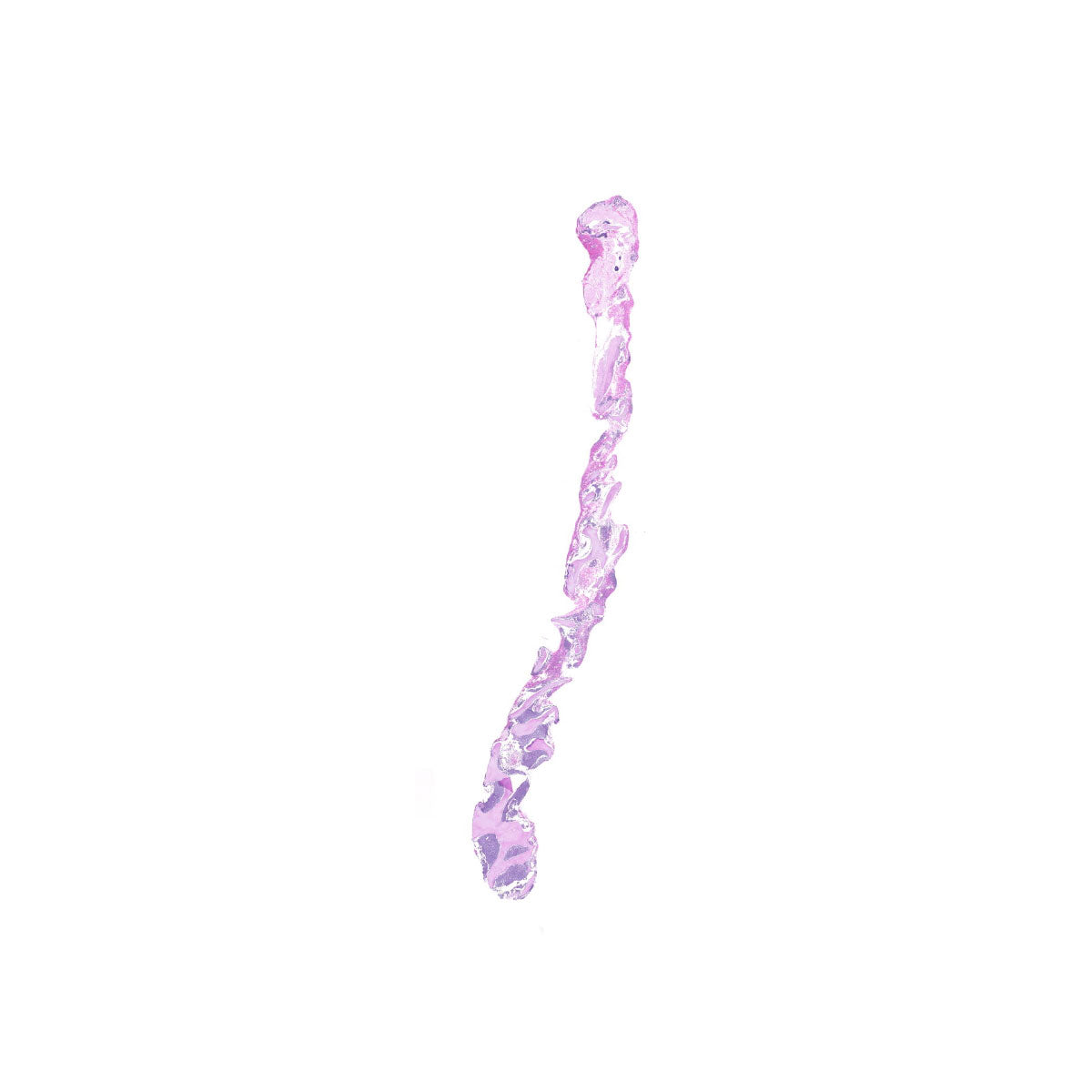 Human FFPE NAT Bone Tissue HuN-04-0012