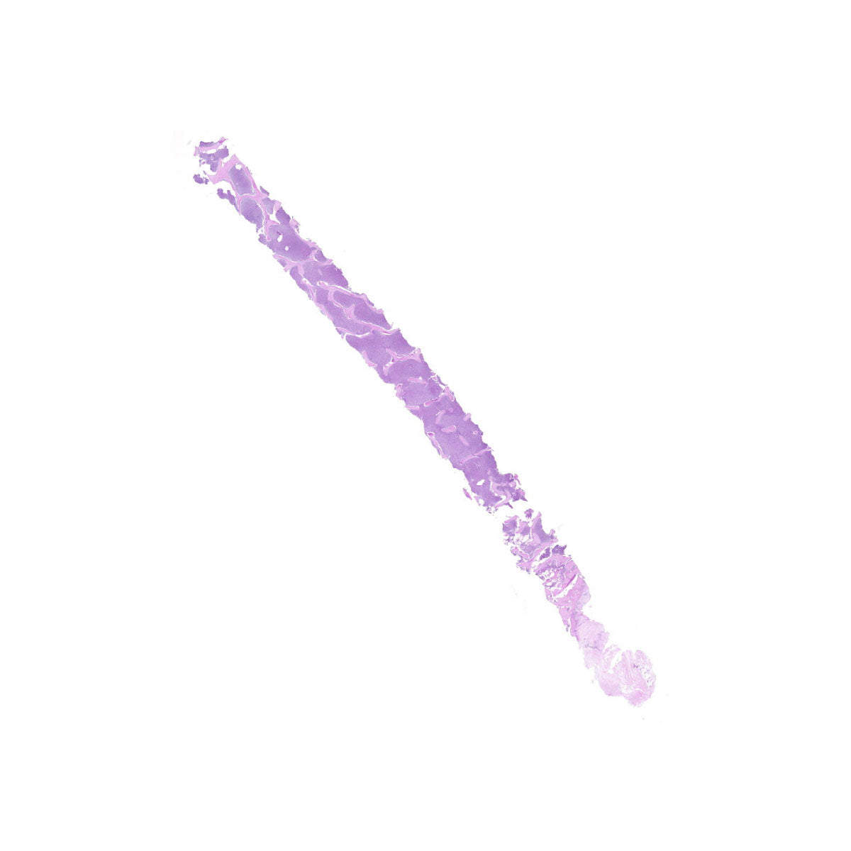 Human FFPE NAT Bone Tissue HuN-04-0013