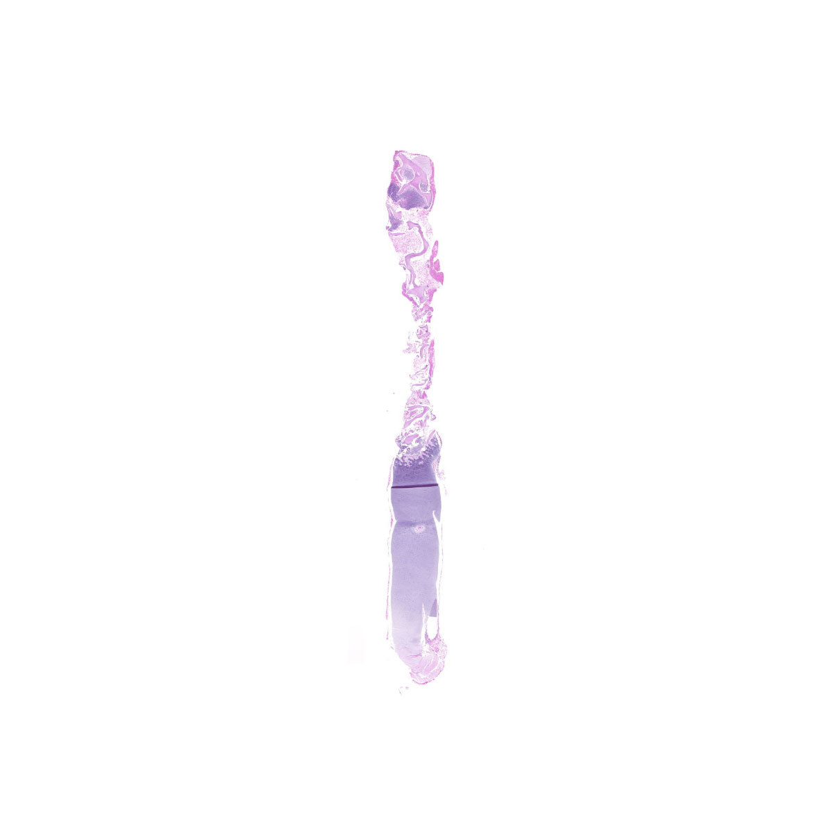 Human FFPE NAT Bone Tissue HuN-04-0014