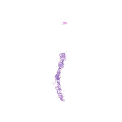 Human FFPE NAT Bone Tissue HuN-04-0015