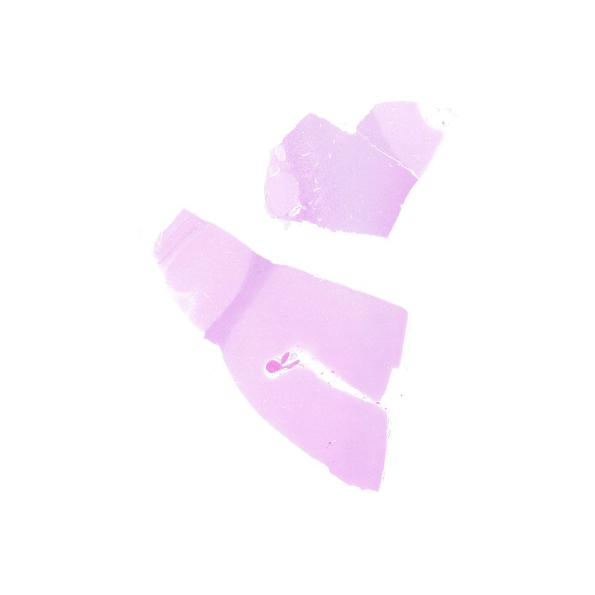 Human FFPE NAT Brain Tissue HuN-05-0050B
