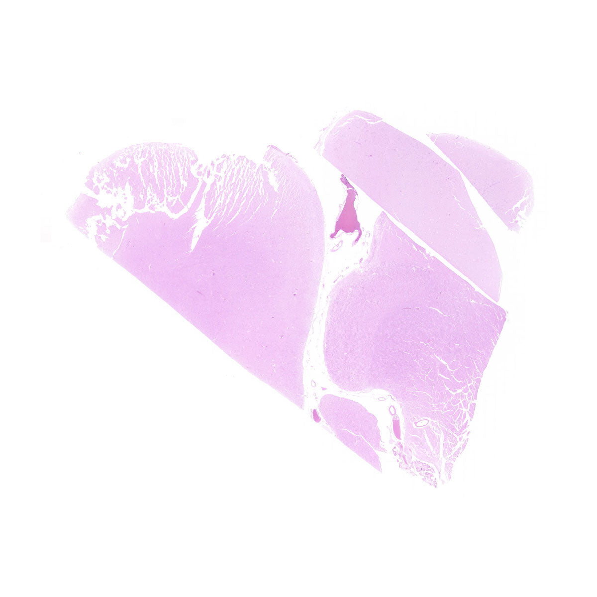 Human FFPE NAT Brain Tissue HuN-05-0051B