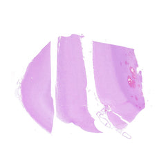 Human FFPE NAT Brain Tissue HuN-05-0064