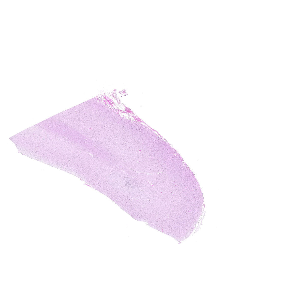 Human FFPE NAT Brain Tissue HuN-05-0081A
