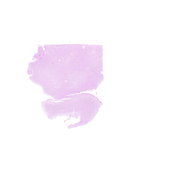 Human FFPE NAT Brain Tissue HuN-05-0082A