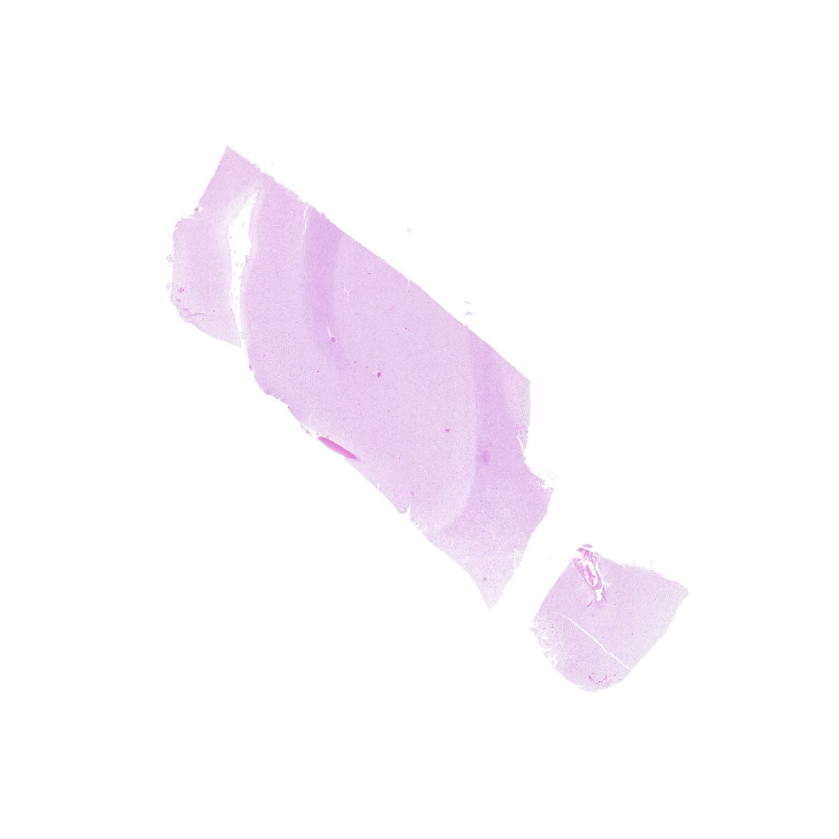 Human FFPE NAT Brain Tissue HuN-05-0084B