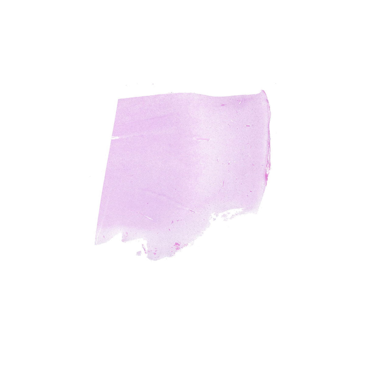 Human FFPE NAT Brain Tissue HuN-05-0086A