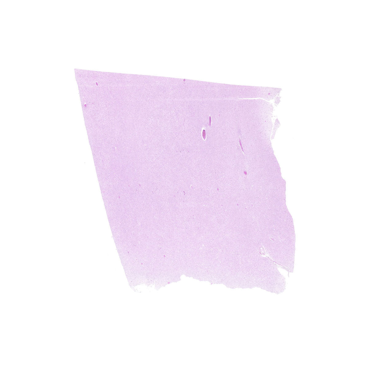 Human FFPE NAT Brain Tissue HuN-05-0086B
