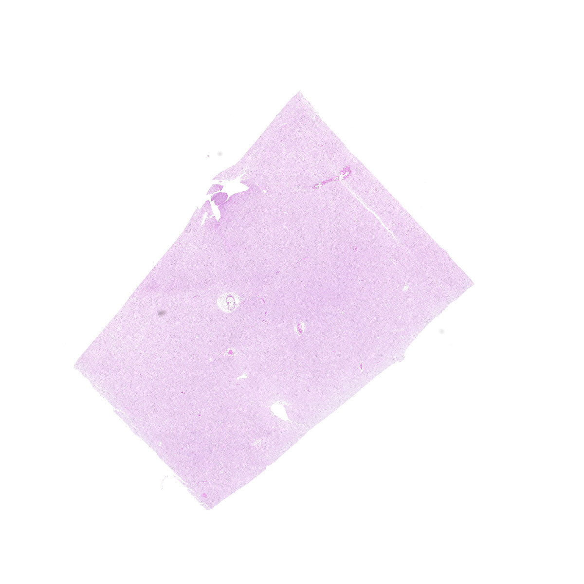 Human FFPE NAT Brain Tissue HuN-05-0087B
