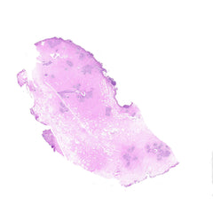 Human FFPE NAT Breast Tissue HuN-06-0028