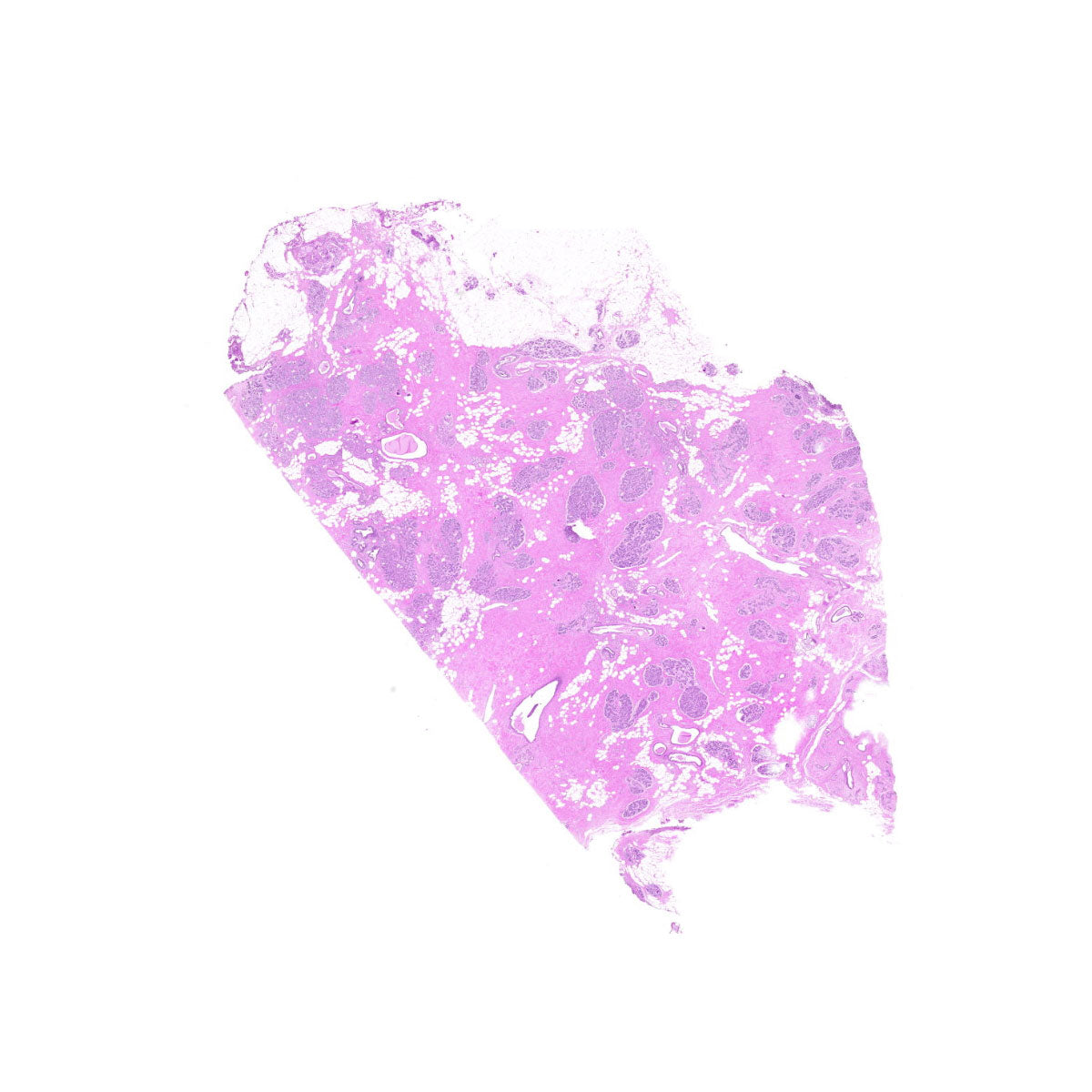 Human FFPE NAT Breast Tissue HuN-06-0032