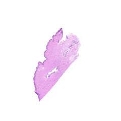 Human FFPE NAT Breast Tissue HuN-06-0047B