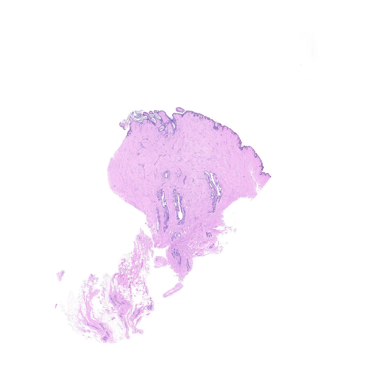 Human FFPE NAT Breast Tissue HuN-06-0048