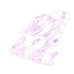 Human FFPE NAT Breast Tissue HuN-06-0051A