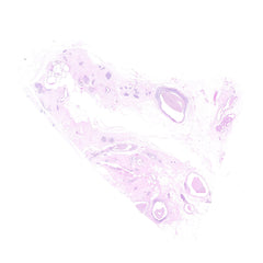 Human FFPE NAT Breast Tissue HuN-06-0051B