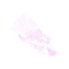 Human FFPE NAT Breast Tissue HuN-06-0053B