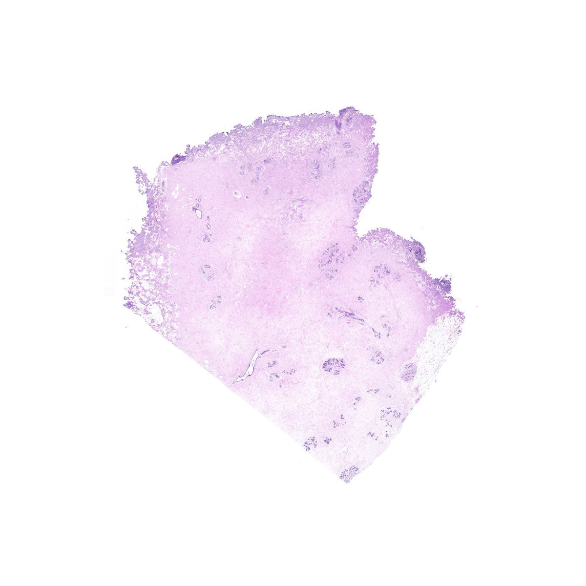 Human FFPE NAT Breast Tissue HuN-06-0056