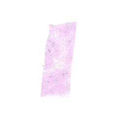 Human FFPE NAT Breast Tissue HuN-06-0061A