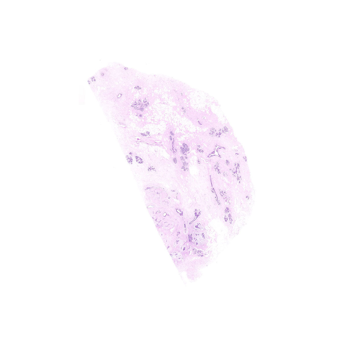 Human FFPE NAT Breast Tissue HuN-06-0064