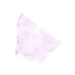 Human FFPE NAT Breast Tissue HuN-06-0069A